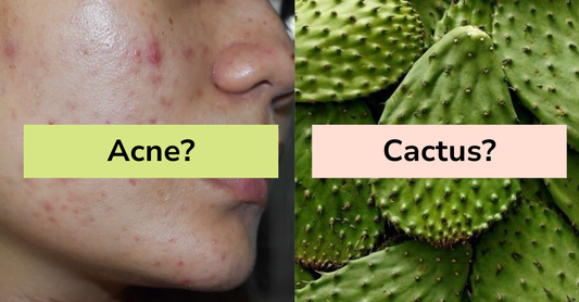 Natural remedy for acne: Cactus hydration and healing