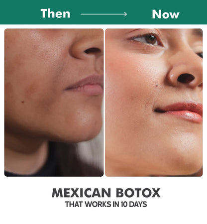 India’s First Mexican Cactus-Infused Skin Tightening Gel Cream